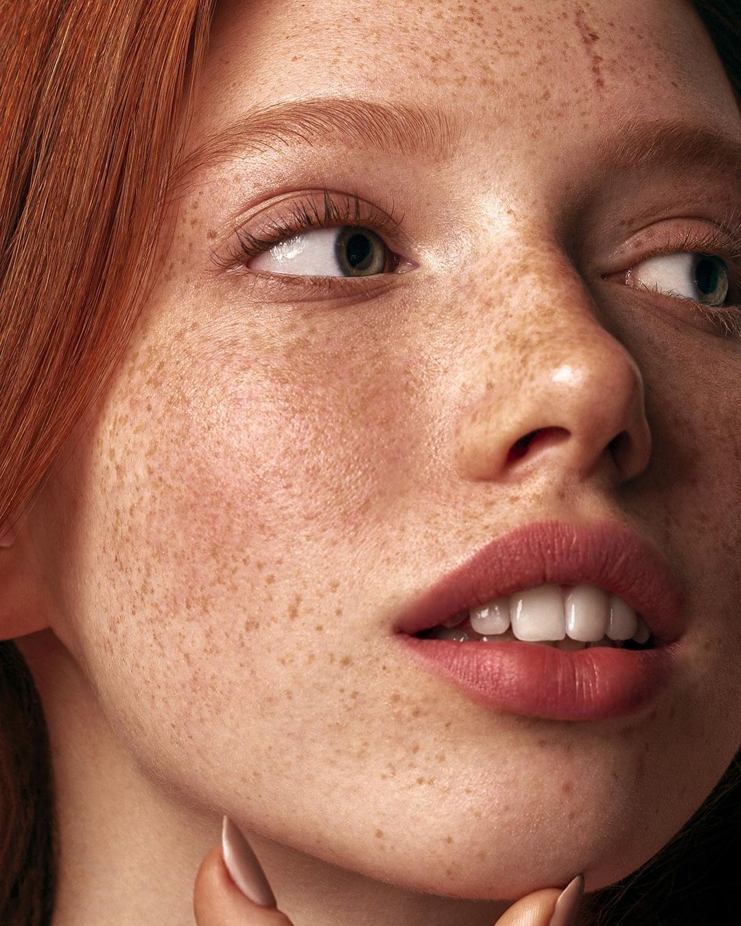 Freckle treatment